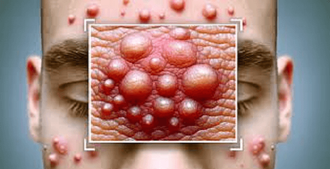 skin rashes